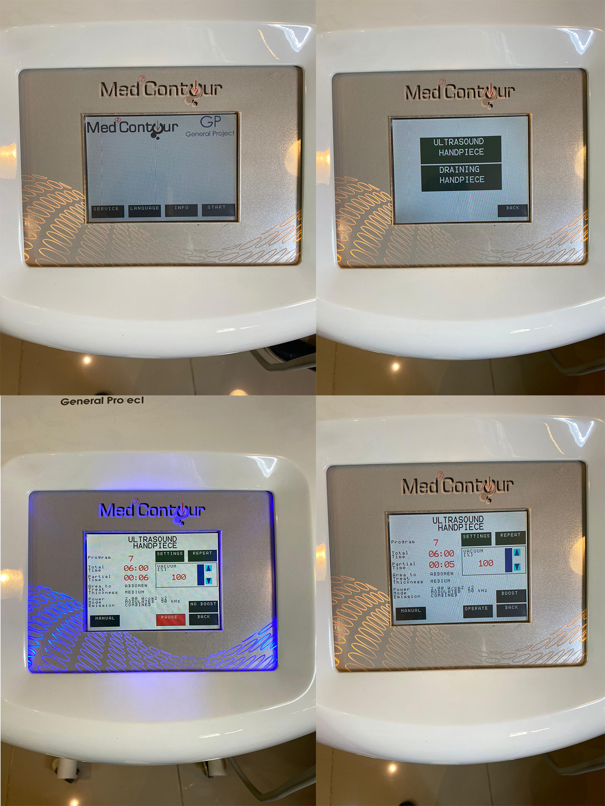 MED2CONTOUR DERİNLİK TARAMA DUAL KAVİTASYON SİSTEMİ