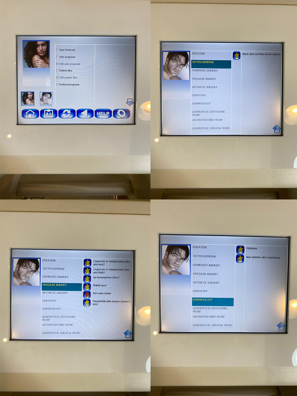 Nd:YAG LAZER VEGA 10.64